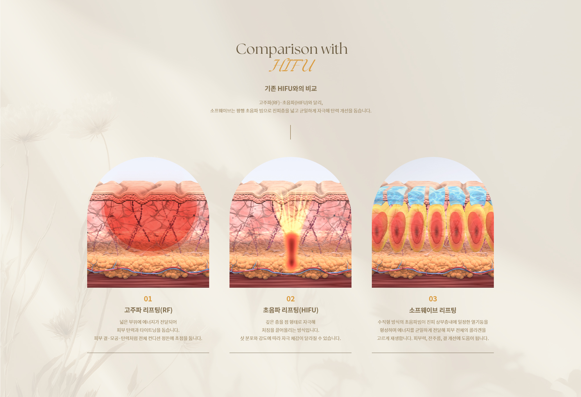 [기존 HIFU와의 비교] 고주파(RF)·초음파(HIFU)와 달리, 소프웨이브는 평행 초음파 빔으로 진피층을 넓고 균일하게 자극해 탄력 개선을 돕습니다.