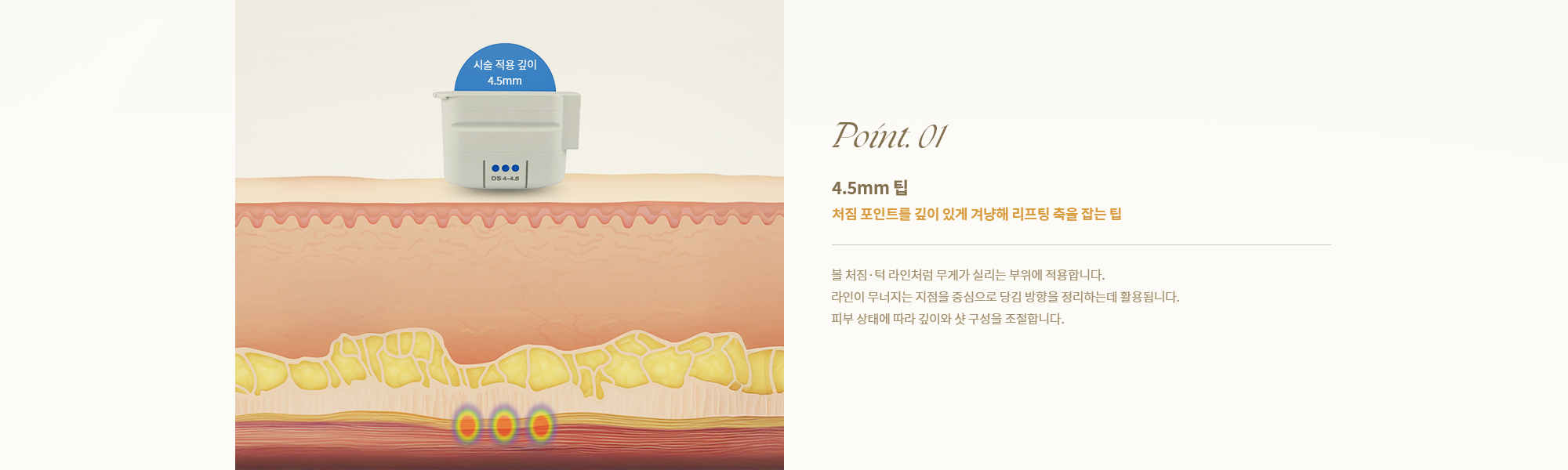 [Point. 01] 4.5mm 팁 : 처짐 포인트를 깊이 있게 겨냥해 리프팅 축을 잡는 팁] 볼 처짐·턱 라인처럼 무게가 실리는 부위에 적용합니다.