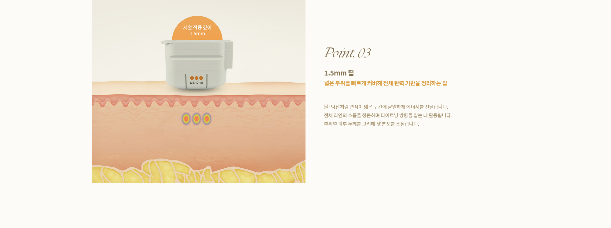 [Point. 03] 1.5mm 팁 : 넓은 부위를 빠르게 커버해 전체 탄력 기반을 정리하는 팁] 볼·턱선처럼 면적이 넓은 구간에 균일하게 에너지를 전달합니다.